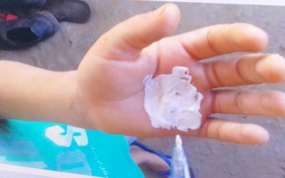 Mãe embebeda, agride com triciclo e queima mão do filho