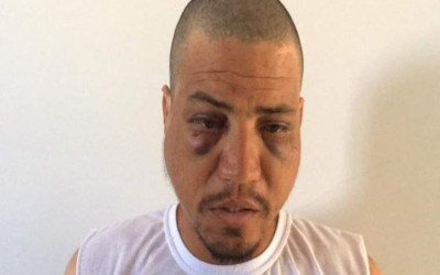 Homem surta e tenta matar a mãe queimada no Entorno do DF