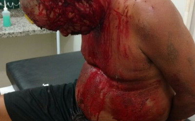 Ao tirar satisfação com suposto invasor, jovem é esfaqueado no bairro Santa Luzia