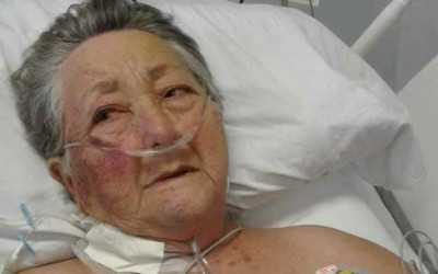 Idosa de 78 anos é agredida por enfermeiro de UTI em São Paulo 