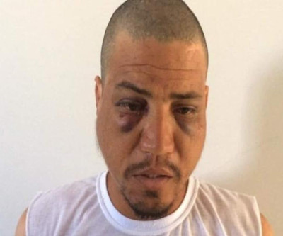 Homem surta e tenta matar a mãe queimada no Entorno do DF