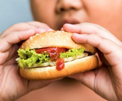 Obesidade infantil acende alerta em Mato Grosso do Sul