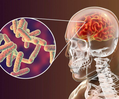 Três Lagoas confirma novo caso de meningite meningocócica e Saúde reforça medidas de prevenção