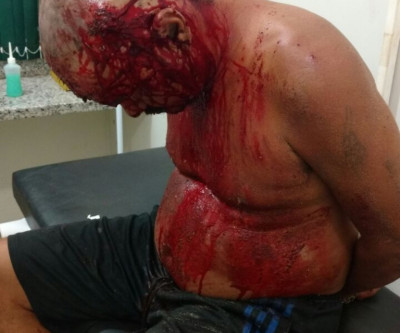 Ao tirar satisfação com suposto invasor, jovem é esfaqueado no bairro Santa Luzia