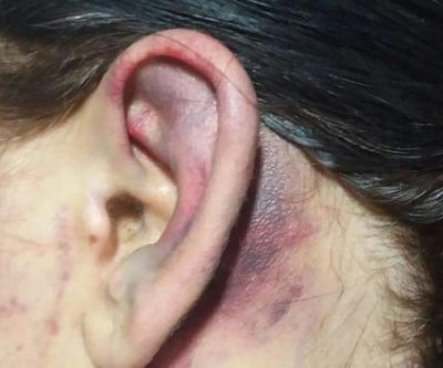 Homem pula muro da casa de ex a espanca e volta para sua casa