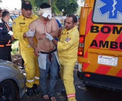 Homem totalmente drogado explode um olho e o outro olho insere o dedo e puxa para fora