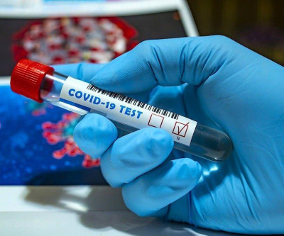 Três Lagoas registra 45 novos casos positivos e mais 23 recuperados da Covid-19 nesta terça-feira (15)