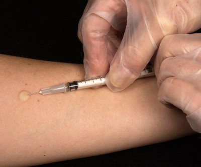 Aplicação da Prova Tuberculínica (PPD) passa a ser realizada em novo endereço em Três Lagoas