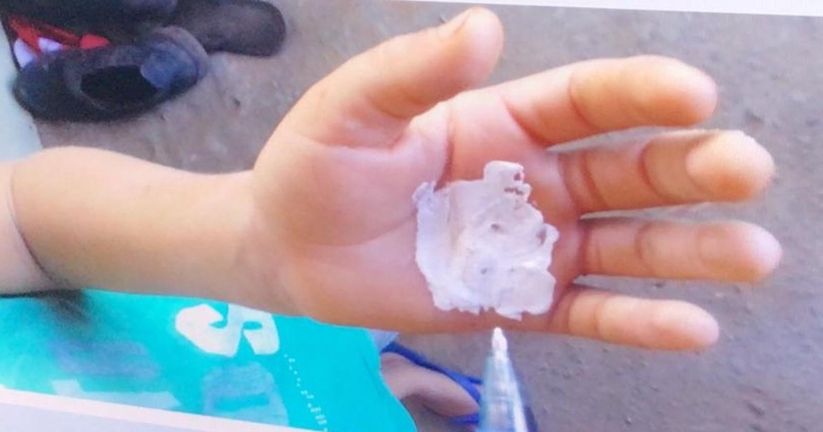 Mãe embebeda, agride com triciclo e queima mão do filho