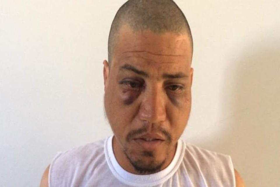 Homem surta e tenta matar a mãe queimada no Entorno do DF