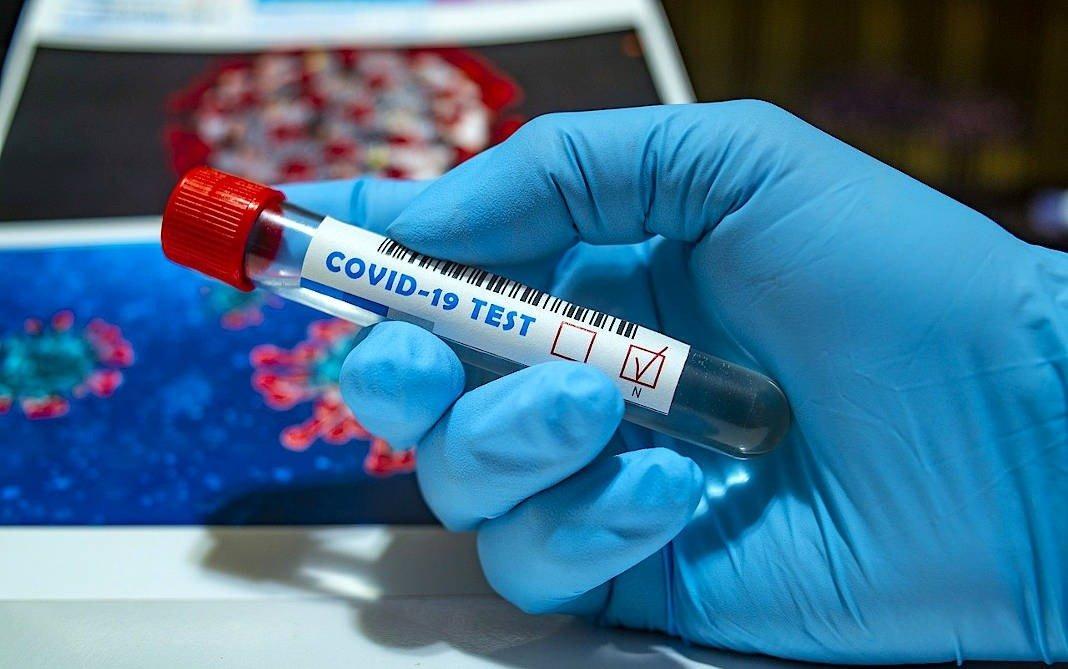 Três Lagoas registra 45 novos casos positivos e mais 23 recuperados da Covid-19 nesta terça-feira (15) Três Lagoas registra 45 novos casos positivos e mais 23 recuperados da Covid-19 nesta terça-feira (15)