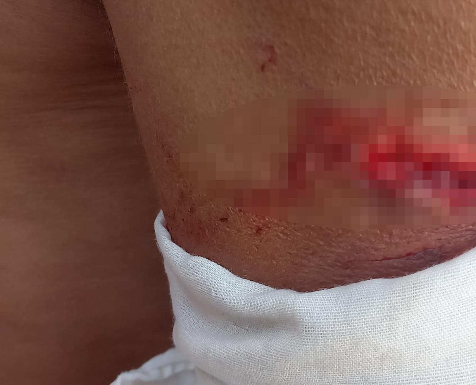 Briga entre desafetos termina com vítima ensanguentada e ataque brutal com “arma improvisada”