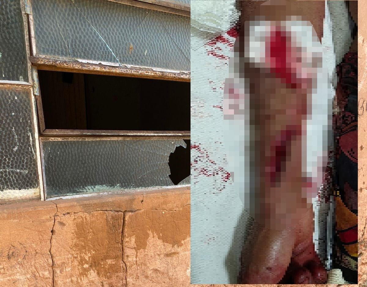 Homem fica gravemente ferido após quebrar vidro com soco durante surto em Três Lagoas