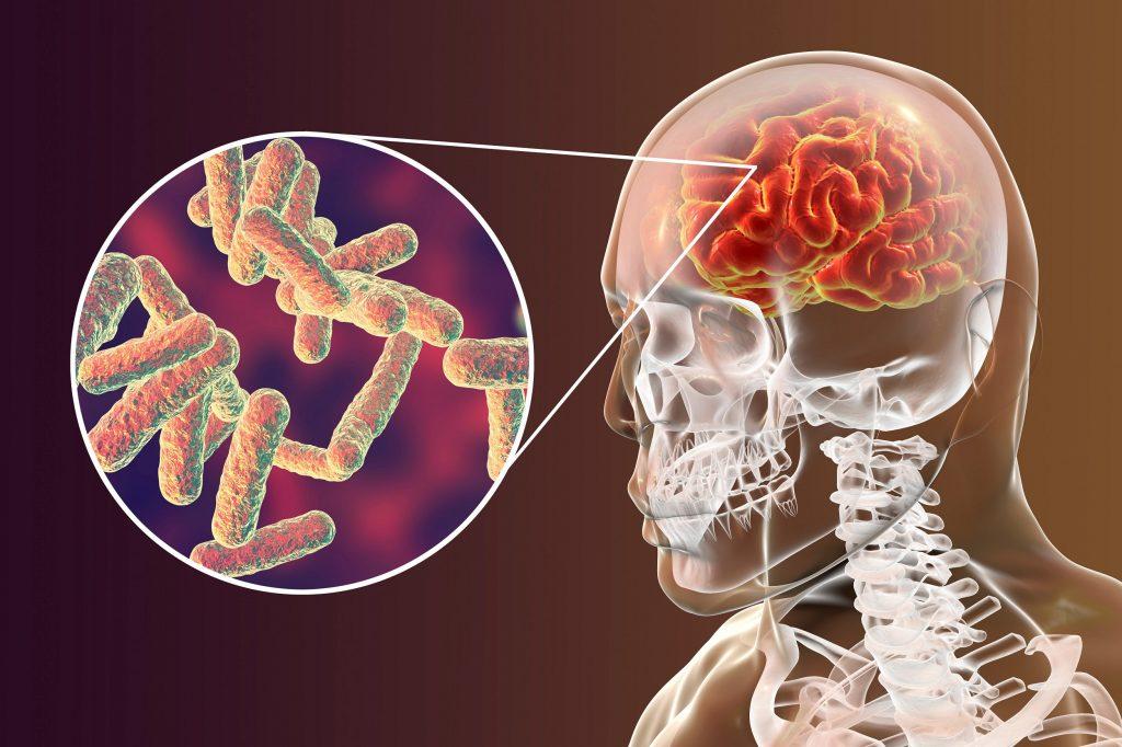 Três Lagoas confirma novo caso de meningite meningocócica e Saúde reforça medidas de prevenção