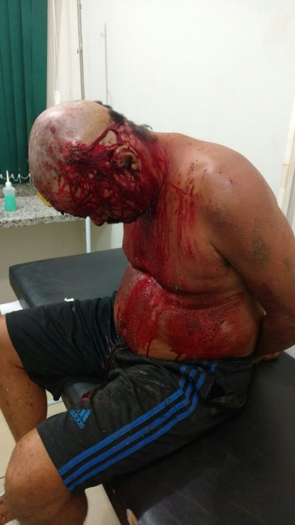 Ao tirar satisfação com suposto invasor, jovem é esfaqueado no bairro Santa Luzia