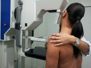 Exame de Mamografia terá fila de espera reduzida em 50% em parceria com o Hospital Auxiliadora